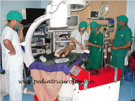 Test for kidney stone
