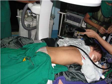ultrasound for kidney stone