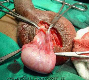 Normal testis