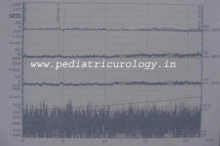 urodynamic test navi mumbai